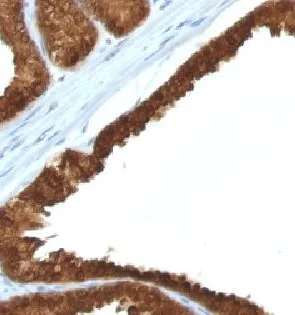 Immunohistochemistry (Formalin/PFA-fixed paraffin-embedded sections) - Anti-IDH1 antibody [IDH1/1152] (AB215829)