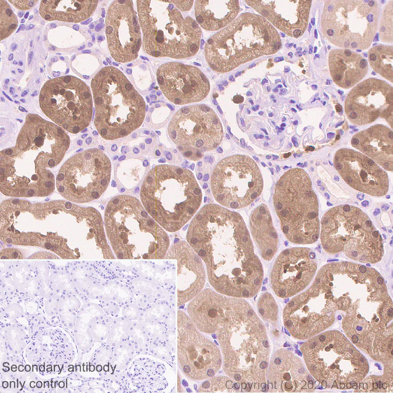 Immunohistochemistry (Formalin/PFA-fixed paraffin-embedded sections) - Anti-IDH1 antibody [RcMab-1] - BSA and Azide free (AB256562)