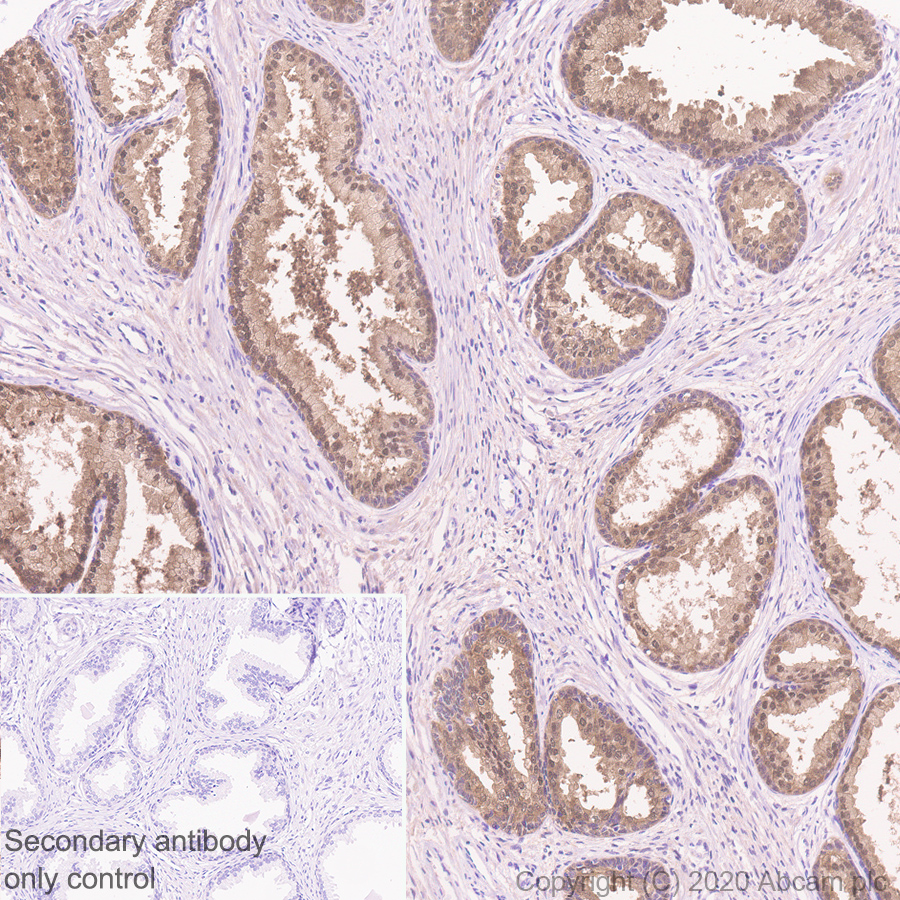 Immunohistochemistry (Formalin/PFA-fixed paraffin-embedded sections) - Anti-IDH1 antibody [RcMab-1] - BSA and Azide free (AB256562), expandable thumbnail