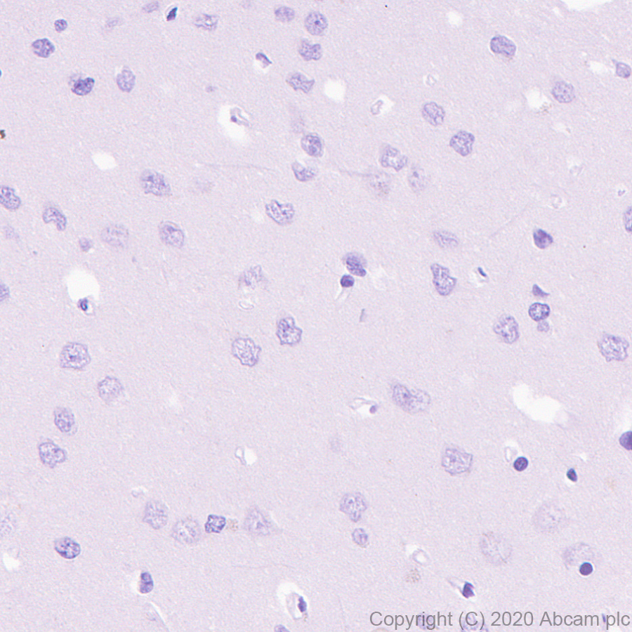 Immunohistochemistry (Formalin/PFA-fixed paraffin-embedded sections) - Anti-IDH1 antibody [RcMab-1] - BSA and Azide free (AB256562), expandable thumbnail