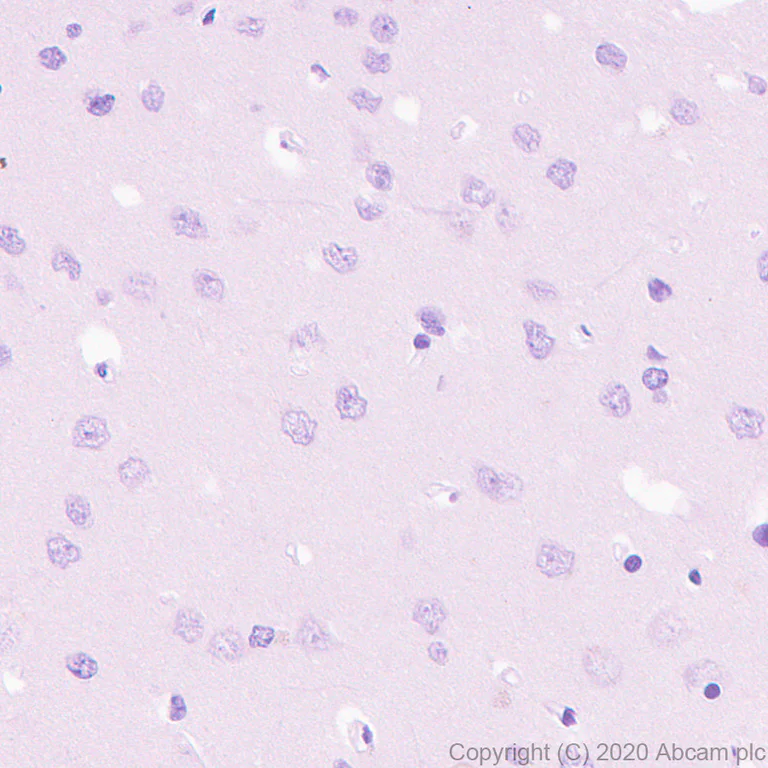 Immunohistochemistry (Formalin/PFA-fixed paraffin-embedded sections) - Anti-IDH1 antibody [RcMab-1] - BSA and Azide free (AB256562)