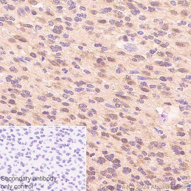 Immunohistochemistry (Formalin/PFA-fixed paraffin-embedded sections) - Anti-IDH1 (mutated R132H) antibody [EPR26774-1] (AB323320)