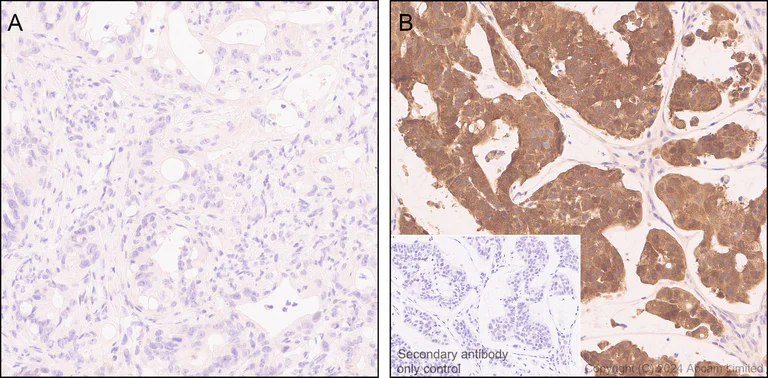 Immunohistochemistry (Formalin/PFA-fixed paraffin-embedded sections) - Anti-IDH1 (mutated R132H) antibody [EPR26774-1] (AB323320)