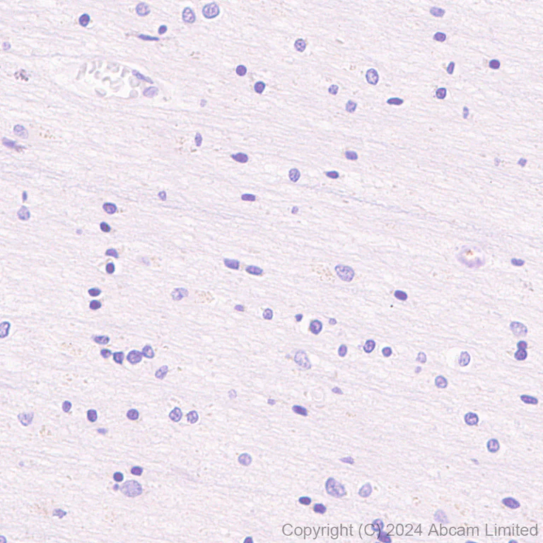 Immunohistochemistry (Formalin/PFA-fixed paraffin-embedded sections) - Anti-IDH1 (mutated R132H) antibody [EPR26774-1] (AB323320)