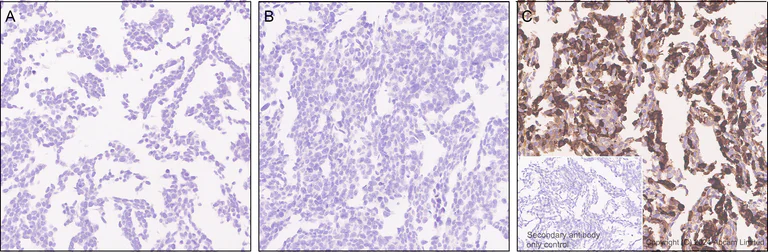 Immunohistochemistry (Formalin/PFA-fixed paraffin-embedded sections) - Anti-IDH1 (mutated R132H) antibody [EPR26774-1] (AB323320)