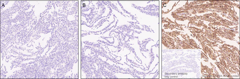 Immunohistochemistry (Formalin/PFA-fixed paraffin-embedded sections) - Anti-IDH1 (mutated R132H) antibody [EPR26774-1] (AB323320)