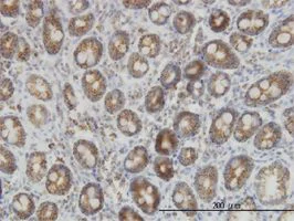 Immunohistochemistry (Formalin/PFA-fixed paraffin-embedded sections) - Anti-IDH2 antibody [5F11] (AB55271)