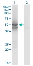 Western blot - Anti-IDH2 antibody [5F11] (AB55271), expandable thumbnail