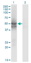 Western blot - Anti-IDH2 antibody [5F11] (AB55271)