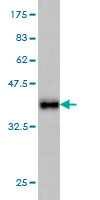 Western blot - Anti-IDH2 antibody [5F11] (AB55271), expandable thumbnail