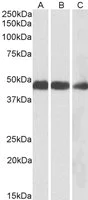 Western blot - Anti-IDH2 antibody (AB109588)