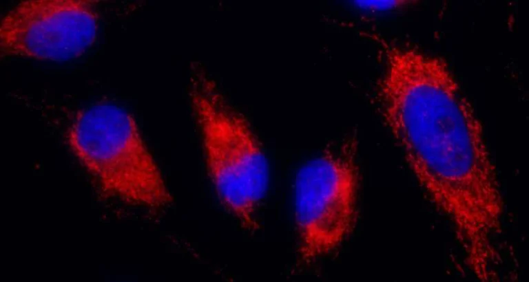 Immunocytochemistry - Anti-IDH2 antibody (AB177512)
