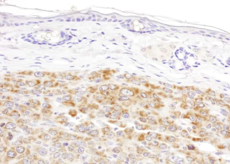 Immunohistochemistry (Formalin/PFA-fixed paraffin-embedded sections) - Anti-IDH2 antibody (AB177512)