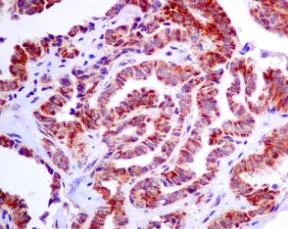 Immunohistochemistry (Formalin/PFA-fixed paraffin-embedded sections) - Anti-IDH2 antibody [EPR7576] - BSA and Azide free (AB246343)