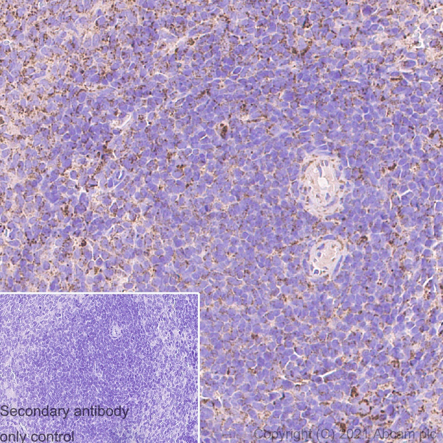 Immunohistochemistry (Formalin/PFA-fixed paraffin-embedded sections) - Anti-IDH2 antibody [EPR7577] (ab131263), expandable thumbnail