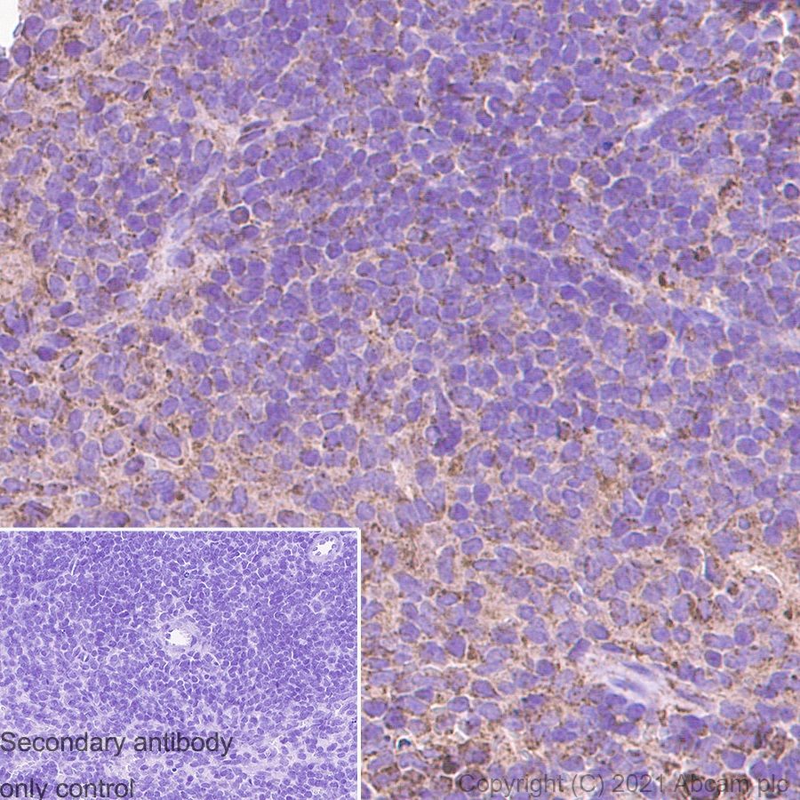 Immunohistochemistry (Formalin/PFA-fixed paraffin-embedded sections) - Anti-IDH2 antibody [EPR7577] (AB131263), expandable thumbnail
