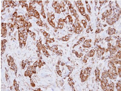 Immunohistochemistry (Formalin/PFA-fixed paraffin-embedded sections) - Anti-IDH3A antibody (AB154886)