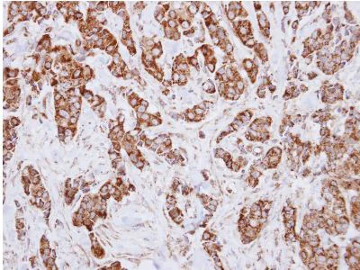 Immunohistochemistry (Formalin/PFA-fixed paraffin-embedded sections) - Anti-IDH3A antibody (AB154886)