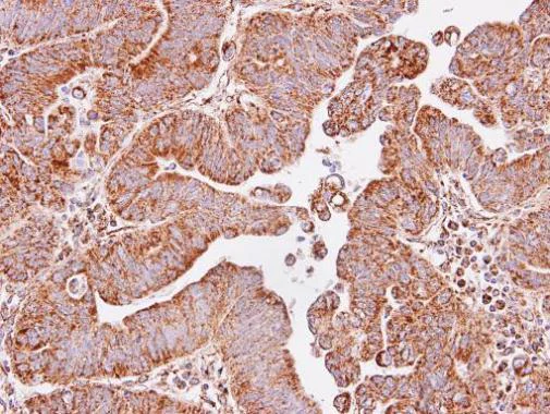 Immunohistochemistry (Formalin/PFA-fixed paraffin-embedded sections) - Anti-IDH3A antibody (AB228596)
