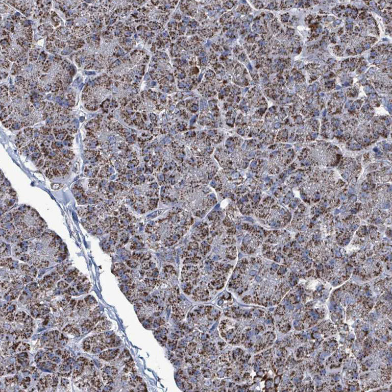 Immunohistochemistry (Formalin/PFA-fixed paraffin-embedded sections) - Anti-IDH3B antibody (AB247089)