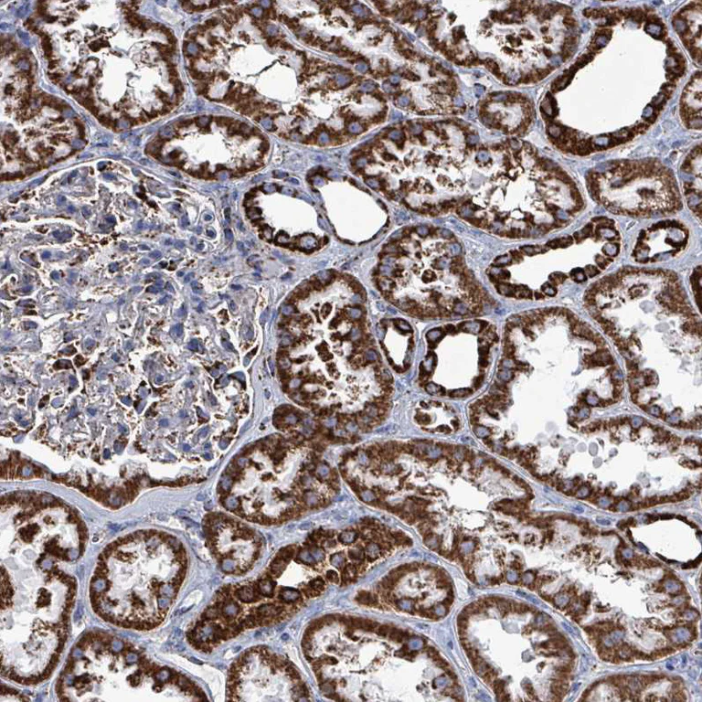 Immunohistochemistry (Formalin/PFA-fixed paraffin-embedded sections) - Anti-IDH3B antibody (AB247089)