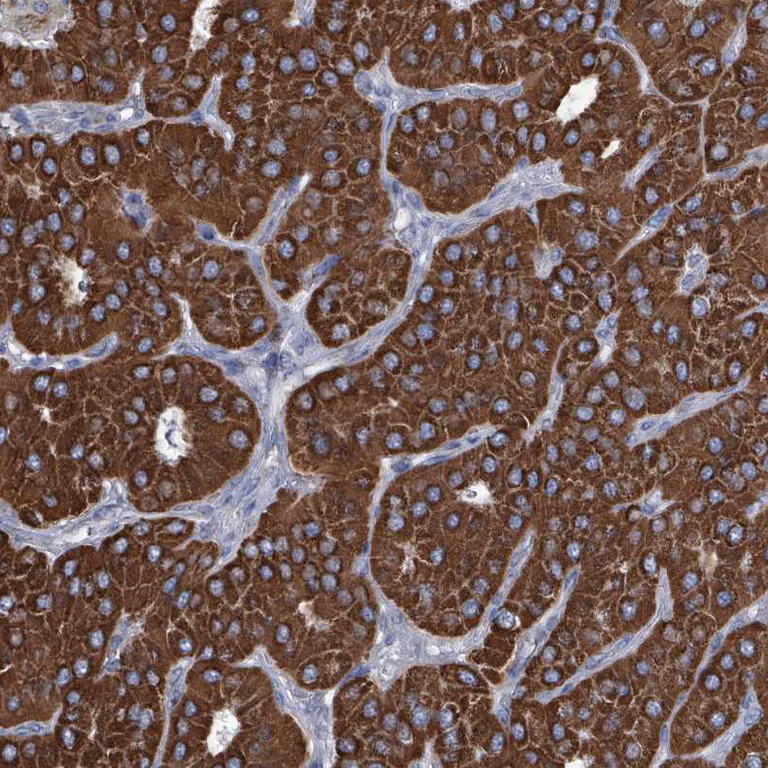 Immunohistochemistry (Formalin/PFA-fixed paraffin-embedded sections) - Anti-IDH3B antibody (AB247089)