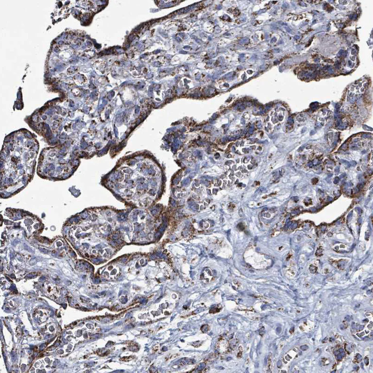 Immunohistochemistry (Formalin/PFA-fixed paraffin-embedded sections) - Anti-IDH3B antibody (AB247089)