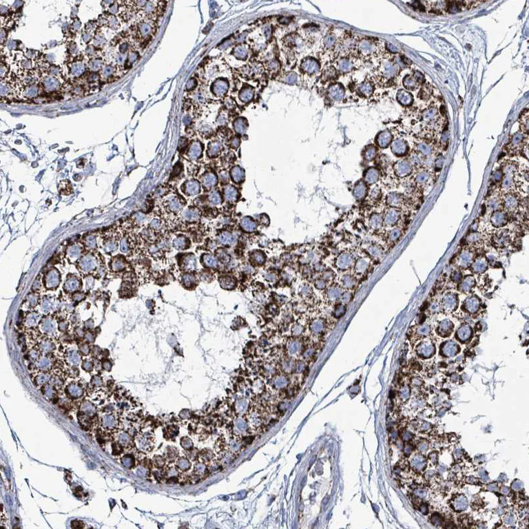Immunohistochemistry (Formalin/PFA-fixed paraffin-embedded sections) - Anti-IDH3B antibody (AB247089)