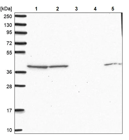 Western blot - Anti-IDH3B antibody (AB247089)