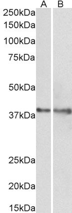 Western blot - Anti-IDH3G antibody (AB118289)