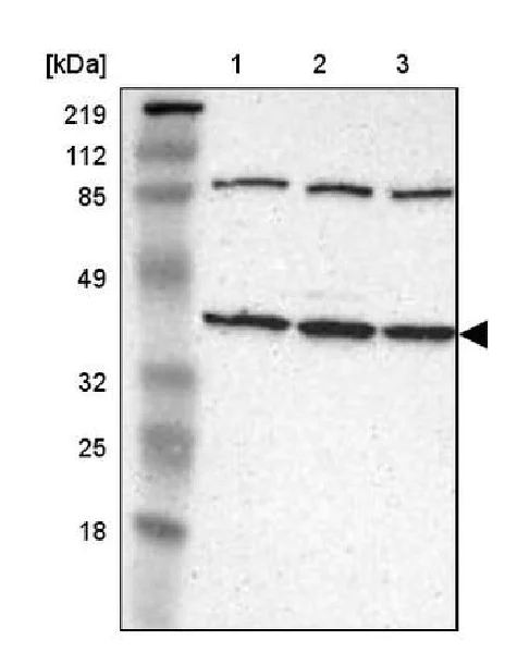 Western blot - Anti-IDH3G antibody (AB224210)