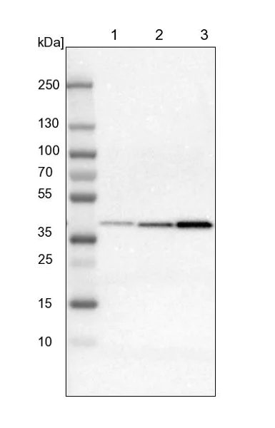 Western blot - Anti-IDH3G antibody (AB224210)