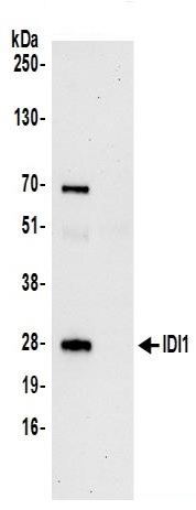 Immunoprecipitation - Anti-IDI1 antibody (AB242049), expandable thumbnail