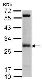 Western blot - Anti-IDI1 antibody (AB97448)