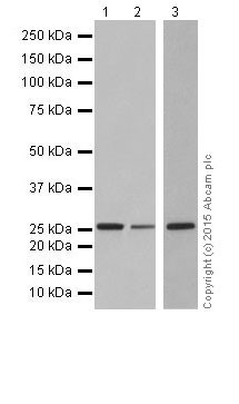 Western blot - Anti-IDI1 + IDI2 antibody [EPR17213] (AB205617), expandable thumbnail