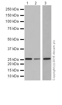 Western blot - Anti-IDI1 + IDI2 antibody [EPR17213] (AB205617)