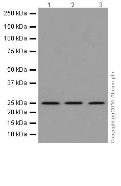 Western blot - Anti-IDI1+IDI2 antibody [EPR17213] - BSA and Azide free (AB251438)