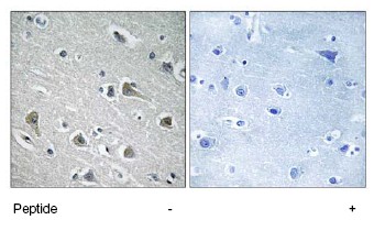 Immunohistochemistry (Formalin/PFA-fixed paraffin-embedded sections) - Anti-IDOL antibody (AB74562)