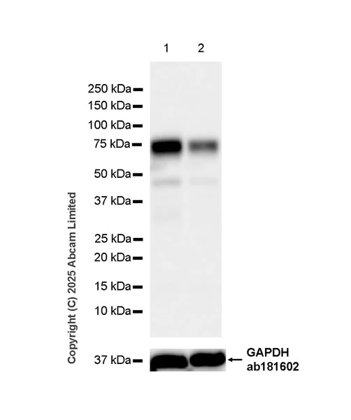 Western blot - Anti-IDUA antibody antibody [EPR26926-251] (AB323701)