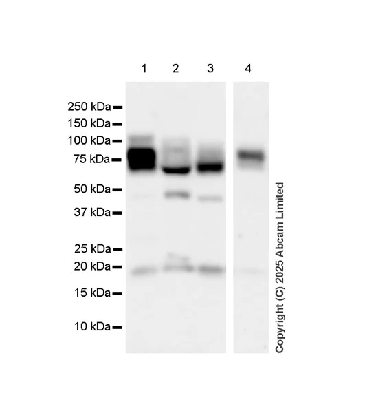 Western blot - Anti-IDUA antibody antibody [EPR26926-251] (AB323701)