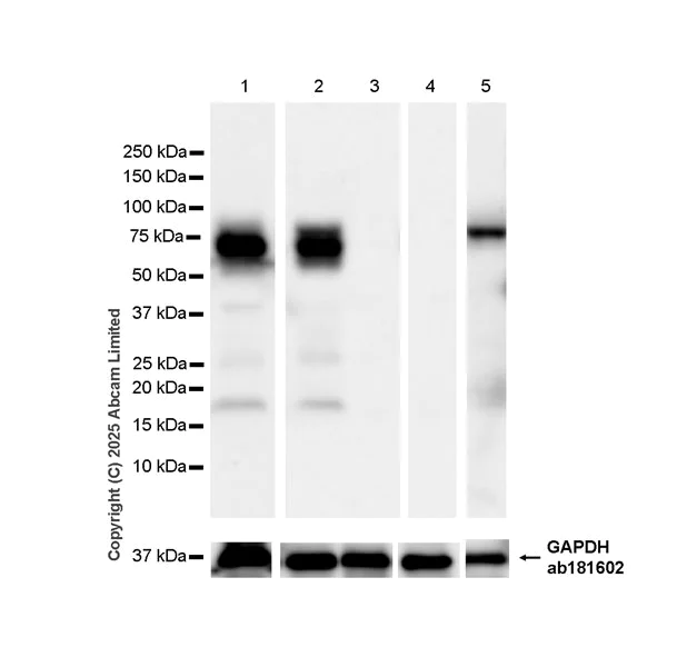 Western blot - Anti-IDUA antibody antibody [EPR26926-251] (AB323701)