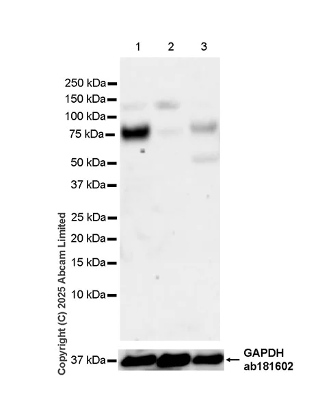 Western blot - Anti-IDUA antibody antibody [EPR26926-251] (AB323701)