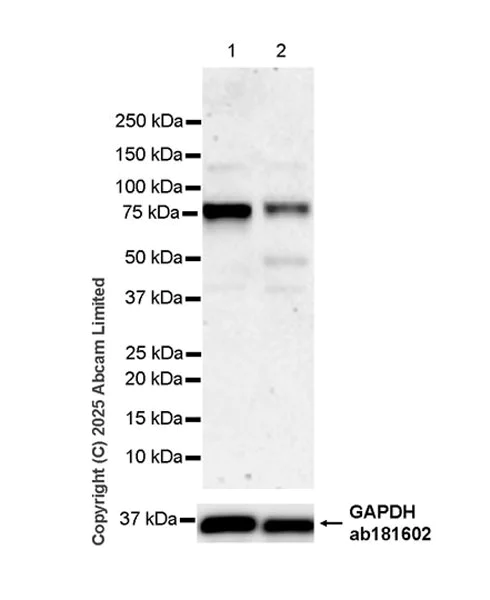 Western blot - Anti-IDUA antibody antibody [EPR26926-251] (AB323701)