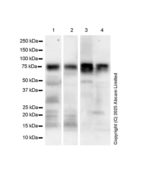 Western blot - Anti-IDUA antibody antibody [EPR26926-251] (AB323701)