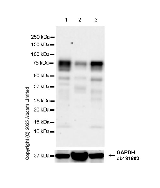Western blot - Anti-IDUA antibody  antibody [EPR26926-251] (ab323701), expandable thumbnail