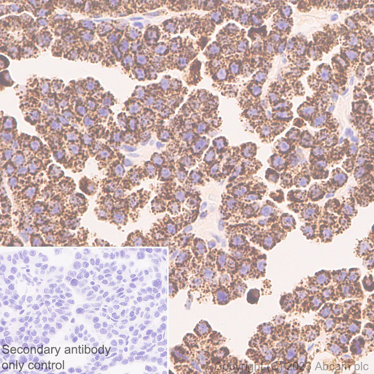 Immunohistochemistry (Formalin/PFA-fixed paraffin-embedded sections) - Anti-Iduronate 2 sulfatase/SIDS antibody [EPR25954-194] (AB314482)