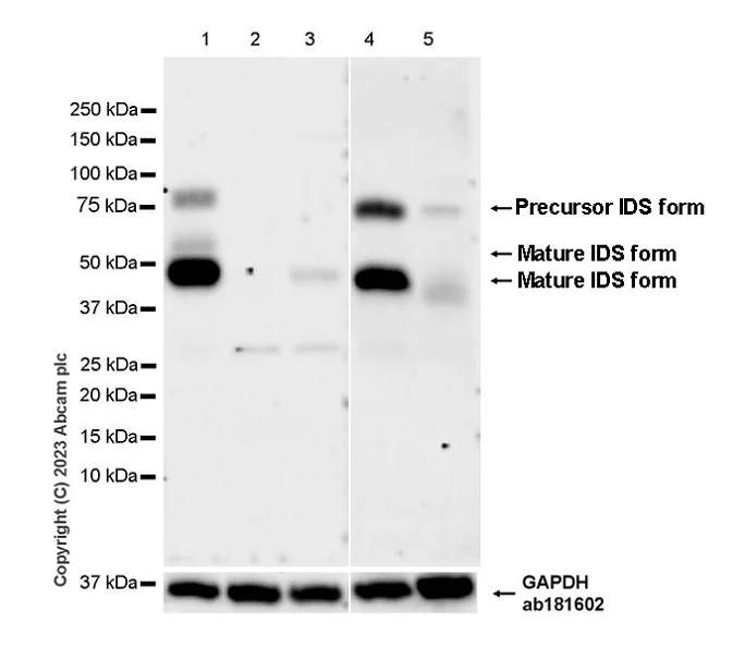 Western blot - Anti-Iduronate 2 sulfatase/SIDS antibody [EPR25954-194] - BSA and Azide free (AB314483)