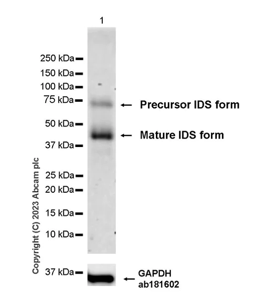 Western blot - Anti-Iduronate 2 sulfatase/SIDS antibody [EPR25954-194] - BSA and Azide free (AB314483)