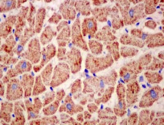 Immunohistochemistry (Formalin/PFA-fixed paraffin-embedded sections) - Anti-IER3IP1 antibody [EPR13440] - BSA and Azide free (AB250460), expandable thumbnail