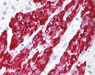 Immunohistochemistry (Formalin/PFA-fixed paraffin-embedded sections) - Anti-IEX1/IER3 antibody (AB65152)